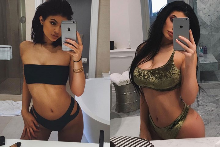 Kylie Jenner Plastic Surgery Before And After N4gm 